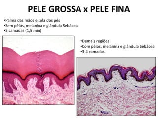 PELE GROSSA x PELE FINA
•Palma das mãos e sola dos pés
•Sem pêlos, melanina e glândula Sebácea
•5 camadas (1,5 mm)

                                          •Demais regiões
                                          •Com pêlos, melanina e glândula Sebácea
                                          •3-4 camadas
 