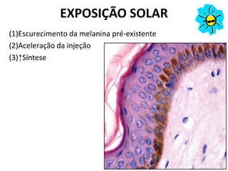 EXPOSIÇÃO SOLAR
(1)Escurecimento da melanina pré-existente
(2)Aceleração da injeção
(3)↑Síntese
 