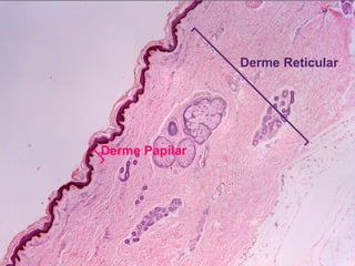 Derme Reticular




Derme Papilar
 