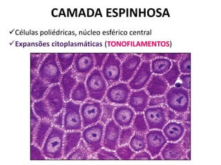CAMADA ESPINHOSA
Células poliédricas, núcleo esférico central
Expansões citoplasmáticas (TONOFILAMENTOS)
 