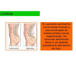 É o aumento anormal da
curva lombar levando a
uma acentuação da
lordose lombar normal
(hiperlordose). Os
músculos abdominais
fracos e um abdome
protuberante são fatores
de risco.
Lordose
 