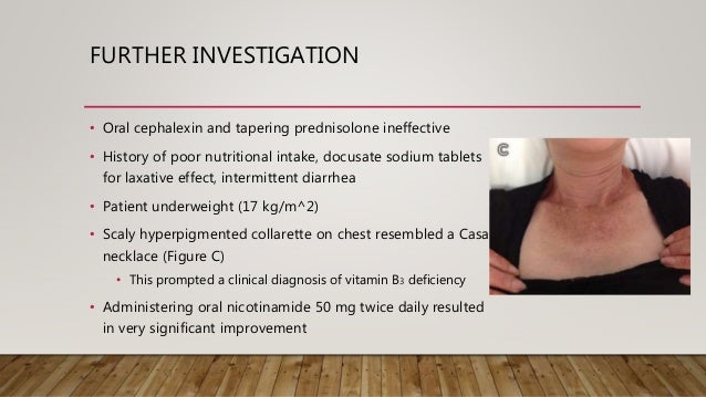 Pellagra case study image