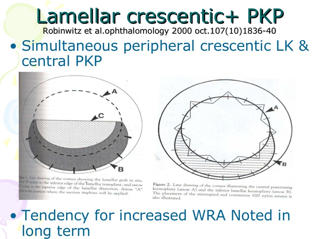 pellucid punctate pellucid punctate