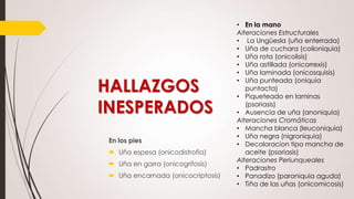HALLAZGOS
INESPERADOS
En los pies
 Uña espesa (onicodistrofia)
 Uña en garra (onicogrifosis)
 Uña encarnada (onicocriptosis)

• En la mano
Alteraciones Estructurales
• La Ungüesla (uña enterrada)
• Uña de cuchara (coiloniquia)
• Uña rota (onicolisis)
• Uña astillada (onicorrexis)
• Uña laminada (onicosquisis)
• Uña punteada (oniquia
puntacta)
• Piqueteado en laminas
(psoriasis)
• Ausencia de uña (anoniquia)
Alteraciones Cromáticas
• Mancha blanca (leuconiquia)
• Uña negra (nigroniquia)
• Decoloracion tipo mancha de
aceite (psoriasis)
Alteraciones Periunqueales
• Padrastro
• Panadizo (paroniquia aguda)
• Tiña de las uñas (onicomicosis)

 