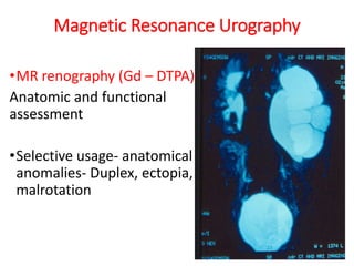Magnetic Resonance Urography
•MR renography (Gd – DTPA)
Anatomic and functional
assessment
•Selective usage- anatomical
anomalies- Duplex, ectopia,
malrotation
 