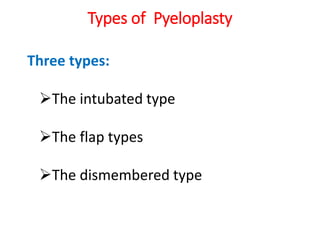 Types of Pyeloplasty
Three types:
The intubated type
The flap types
The dismembered type
 