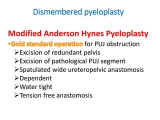 Dismembered pyeloplasty
Modified Anderson Hynes Pyeloplasty
for PUJ obstruction
Excision of redundant pelvis
Excision of pathological PUJ segment
Spatulated wide ureteropelvic anastomosis
Dependent
Water tight
Tension free anastomosis
 