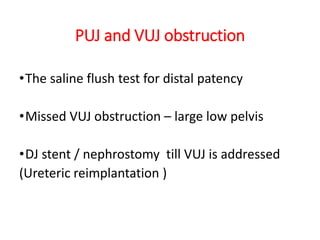 PUJ and VUJ obstruction
•The saline flush test for distal patency
•Missed VUJ obstruction – large low pelvis
•DJ stent / nephrostomy till VUJ is addressed
(Ureteric reimplantation )
 