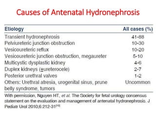 Causes of Antenatal Hydronephrosis
 