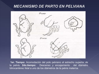 1er. Tiempo: Acomodación del polo pelviano al estrecho superior de
la pelvis. 2do.tiempo: Descenso y encajamiento del diámetro
bitrocantéreo fetal a uno de los diámetros de la pelvis materna.
 