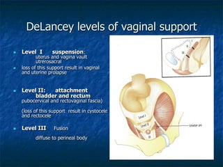 DeLancey levels of vaginal support
n  Level I suspension:
uterus and vagina vault
utrerosacral
n  loss of this support result in vaginal
and uterine prolapse
n  Level II: attachment
bladder and rectum
pubocervical and rectovaginal fascia)
(loss of this support result in cystocele
and rectocele
n  Level III Fusion
diffuse to perineal body
 