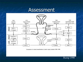 Assessment
Bump 1998
 