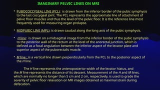 Pcl Line Pelvic anatomy MRI OF MALE AND FEMALE PELVIS.pptx