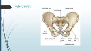 Pelvic inlet
 