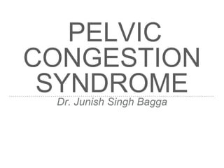 PELVIC
CONGESTION
SYNDROMEDr. Junish Singh Bagga
 