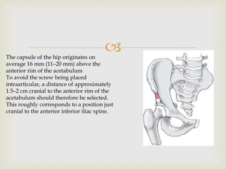 The capsule of the hip originates on
average 16 mm (11–20 mm) above the
anterior rim of the acetabulum
To avoid the screw being placed
intraarticular, a distance of approximately
1.5–2 cm cranial to the anterior rim of the
acetabulum should therefore be selected.
This roughly corresponds to a position just
cranial to the anterior inferior iliac spine.
 