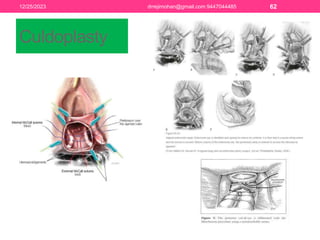 PELVIC FLOOR ANATOMY AND REPAIR.pptx FOR TEACHING | PPTX