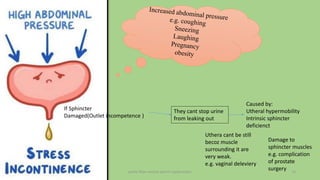 pelvic floor muscle and it's dysfunction 13
If Sphincter
Damaged(Outlet incompetence )
They cant stop urine
from leaking out
Caused by:
Utheral hypermobility
Intrinsic sphincter
deficienct
Uthera cant be still
becoz muscle
surrounding it are
very weak.
e.g. vaginal deleviery
Damage to
sphincter muscles
e.g. complication
of prostate
surgery
 