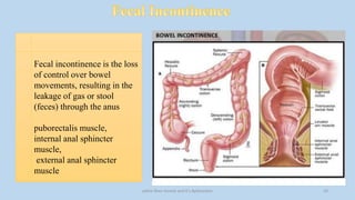 pelvic floor muscle and it's dysfunction 23
Fecal incontinence is the loss
of control over bowel
movements, resulting in the
leakage of gas or stool
(feces) through the anus
puborectalis muscle,
internal anal sphincter
muscle,
external anal sphincter
muscle
 