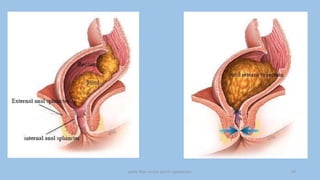 pelvic floor muscle and it's dysfunction 24
 