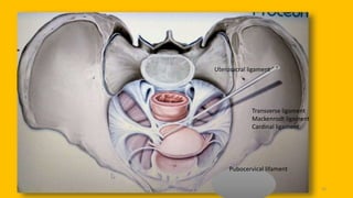 pelvic floor muscle and it's dysfunction 33
Uterosacral ligament
Transverse ligament
Mackenrodt ligament
Cardinal ligament
Pubocervical lifament
 