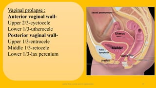 pelvic floor muscle and it's dysfunction 37
Vaginal prolapse :
Anterior vaginal wall-
Upper 2/3-cyctocele
Lower 1/3-utherocele
Posterior vaginal wall-
Upper 1/3-entrocele
Middle 1/3-retocele
Lower 1/3-lax perenium
 