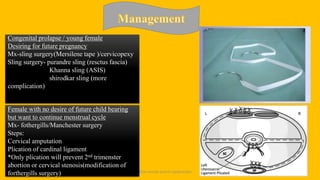 pelvic floor muscle and it's dysfunction 39
Congenital prolapse / young female
Desiring for future pregnancy
Mx-sling surgery(Mersilene tape )/cervicopexy
Sling surgery- purandre sling (resctus fascia)
Khanna sling (ASIS)
shirodkar sling (more
complication)
Female with no desire of future child bearing
but want to continue menstrual cycle
Mx- fothergills/Manchester surgery
Steps:
Cervical amputation
Plication of cardinal ligament
*Only plication will prevent 2nd trimenster
abortion or cervical stenosis(modification of
forthergills surgery)
 
