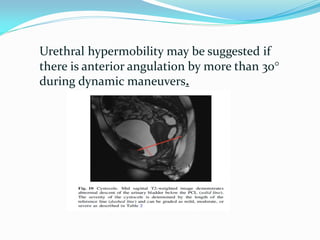 Female pelvic floor dysfunction MRI | PDF