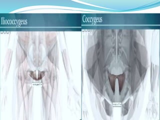 Pelvic floor dysfunction and low back ache | PPTX