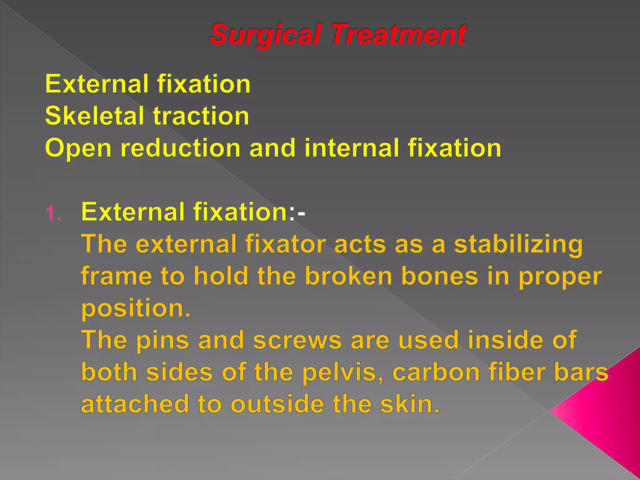 Pelvic fracture