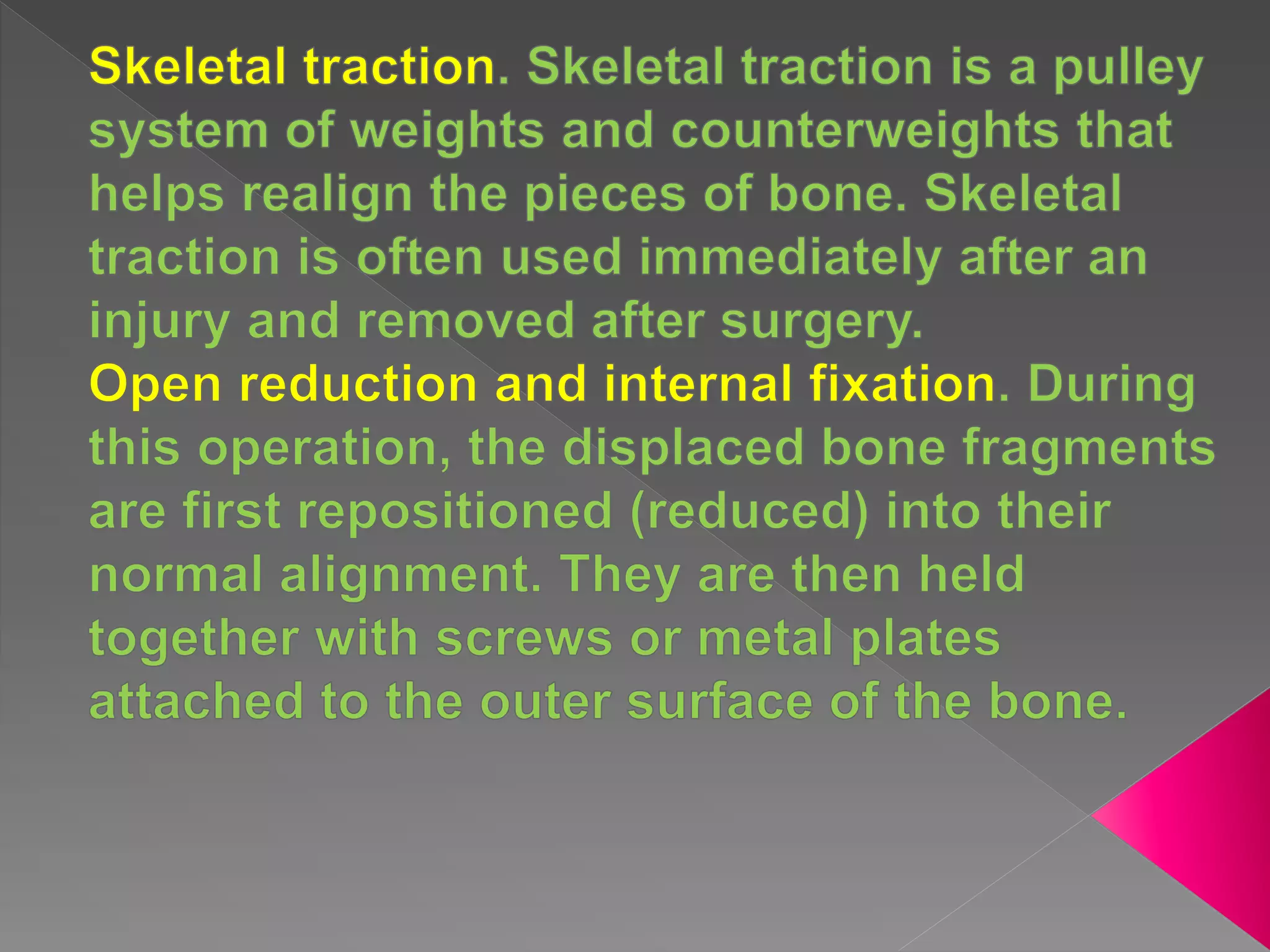 Pelvic fracture