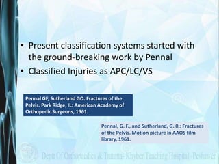 Pelvic fracture classification | PPTX