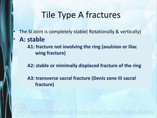 Tile Type A fractures
• The SI Joint is completely stable( Rotationally & vertically)
• Fractures are outside the pelvic r...
