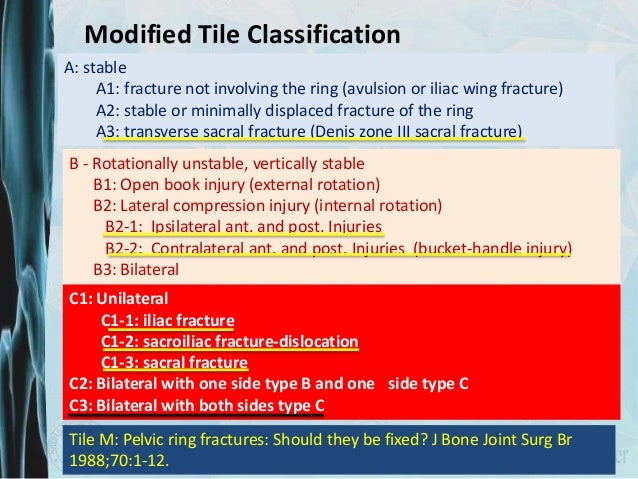 Ring Avulsion Classification Ring Avulsion Classification