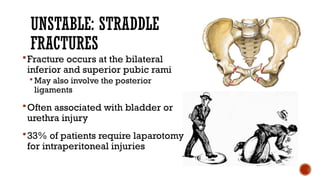 Field management of Pelvic Fracture CME.pptx