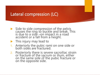 Lateral Compression Text PELVIC FRACTURE ppt by dr.bharti pawar.ppt
