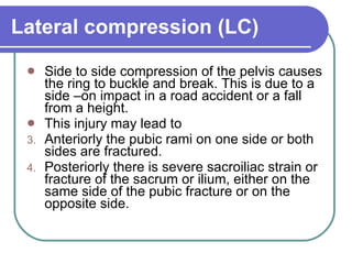 Lateral Compression Text Pelvic fractures | PPT