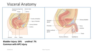 Visceral Anatomy
Bladder injury: 16% urethral 7%
Common with APC injury
2018/01/16 Pelvic Fractures
 