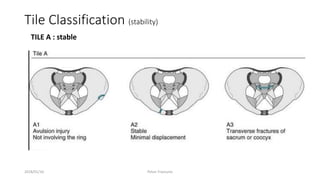 Tile Classification (stability)
TILE A : stable
2018/01/16 Pelvic Fractures
 