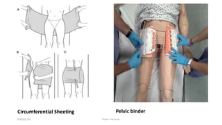 Circumferential Sheeting Pelvic binder
2018/01/16 Pelvic Fractures
 