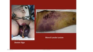 2018/01/16 Pelvic Fractures
 