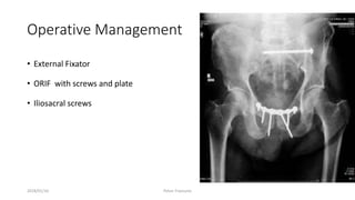 Operative Management
• External Fixator
• ORIF with screws and plate
• Iliosacral screws
2018/01/16 Pelvic Fractures
 