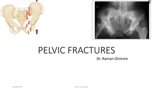 PELVIC FRACTURES
Dr. Raman Ghimire
2018/01/16 Pelvic Fractures
 