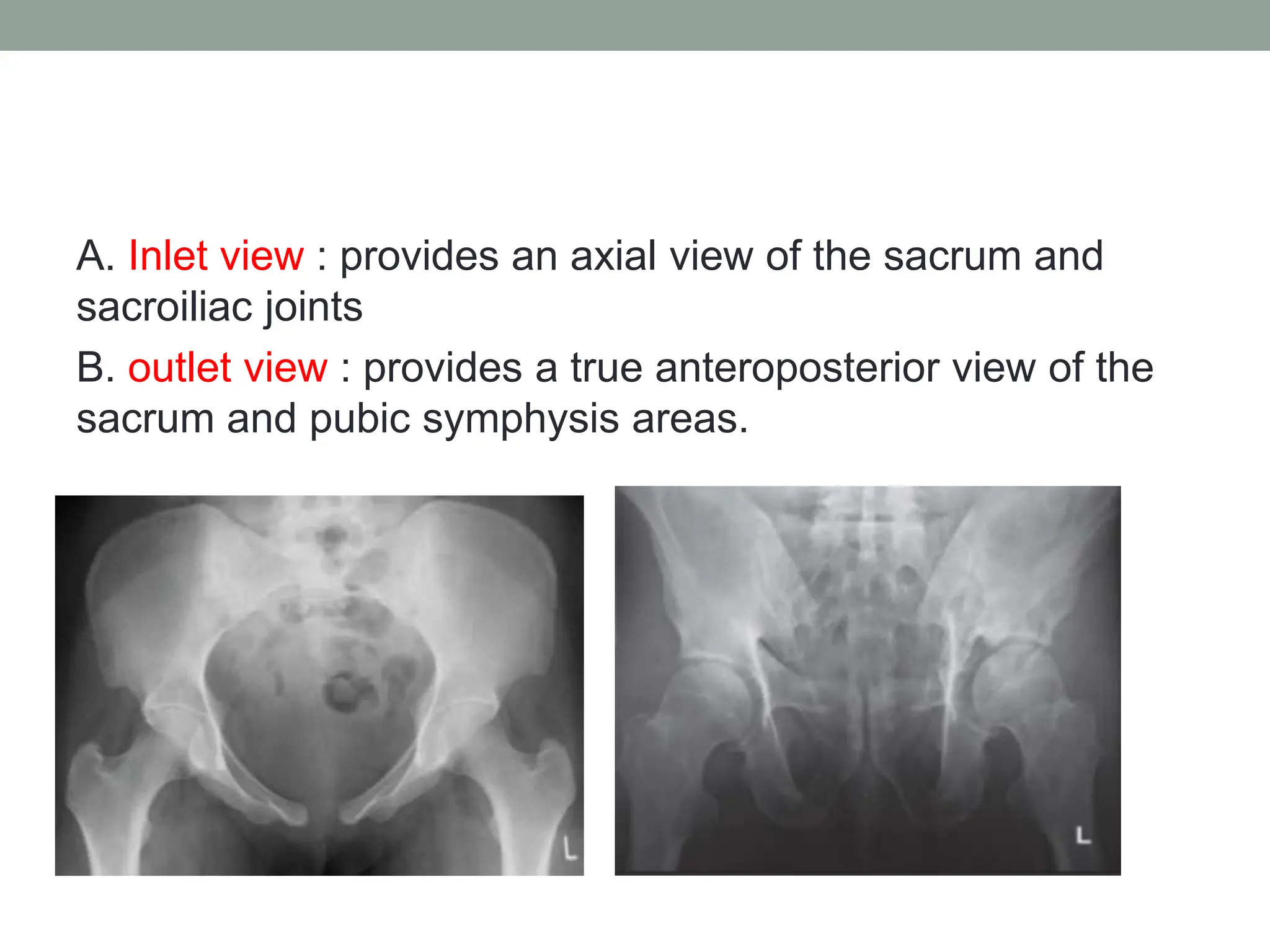 pelvic fractures.pptx