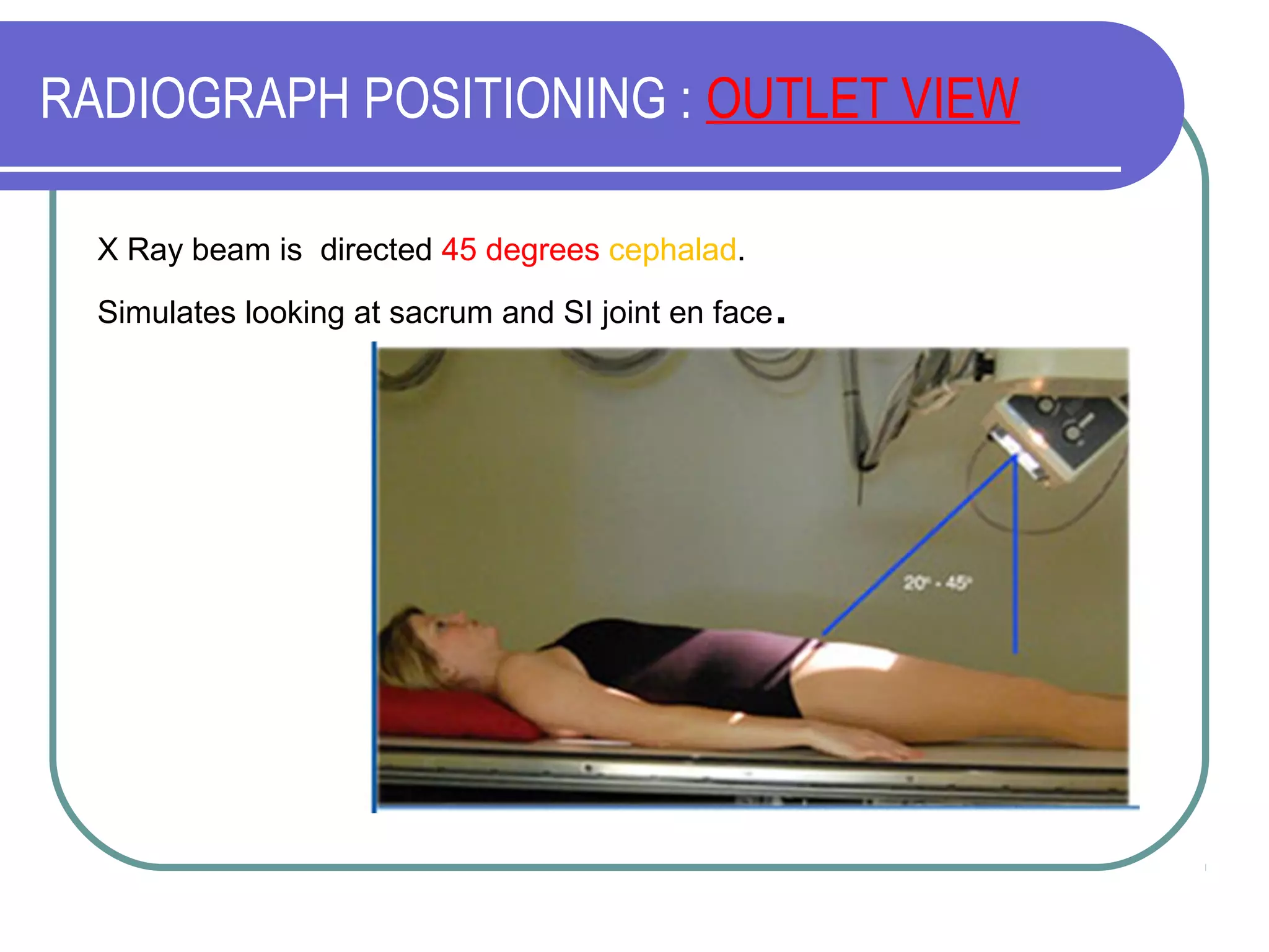Pelvic fractures classification and management | PPT