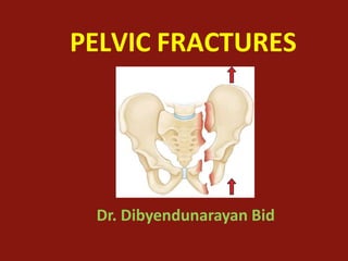 PELVIC FRACTURES
Dr. Dibyendunarayan Bid
 