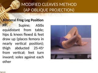 PELVIC GIRDLE (1).pptxfffffgggʻbhhjjjjjjjj | PPTX