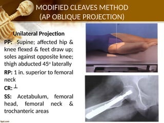 PELVIC GIRDLE (1).pptxfffffgggʻbhhjjjjjjjj | PPTX
