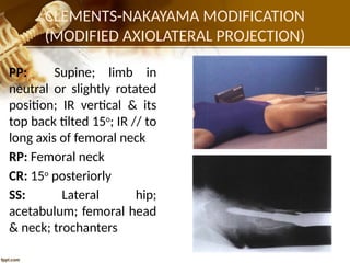 PELVIC GIRDLE (1).pptxfffffgggʻbhhjjjjjjjj | PPTX