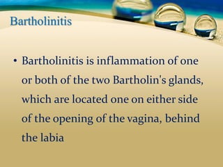 pelvic infection definition cause signs and symptoms diagnosis and ...